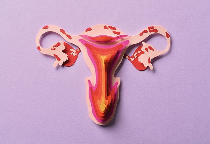 Menstruación retrógrada