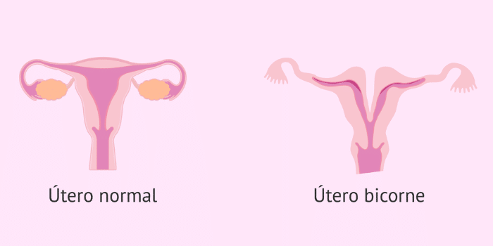 ¿Se pueden sufrir contracciones con la menstruación?