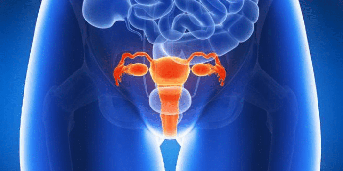 Un poco más sobre la endometriosis